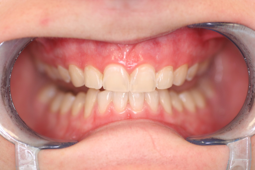 Cosmetic Dentistry Newcastle Belle Dental